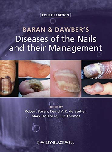 Stock image for Baran & Dawber's Diseases of t for sale by ThriftBooks-Dallas