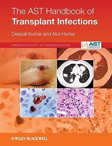 Beispielbild fr The AST Handbook of Transplant Infections zum Verkauf von Blackwell's