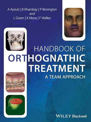 Handbook of Orthognathic Treatment: A Team Approach (9780470659052) by Ayoub, Ashraf; Khambay, Balvinder; Benington, Philip; Green, Lyndia; Moos, Khursheed; Walker, Fraser