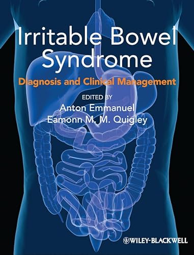 9780470659489: Irritable Bowel Syndrome: Diagnosis and Clinical Management