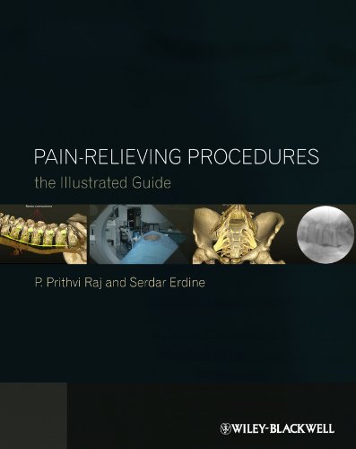 Beispielbild fr Pain-Relieving Procedures: The Illustrated Guide zum Verkauf von HPB-Red