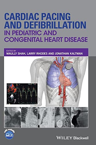 Stock image for Cardiac Pacing And Defibrillation In Pediatric And Congenital Heart Disease (Hb 2017) for sale by Basi6 International