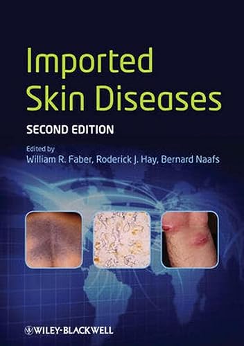 Stock image for Imported Skin Diseases 2Ed (Hb 2013) for sale by Basi6 International