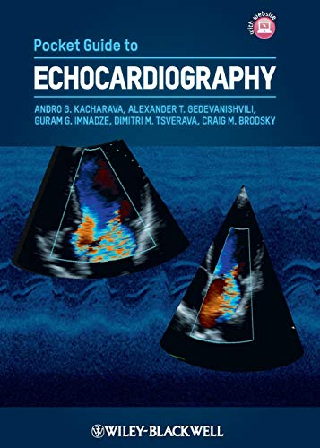Stock image for Pocket Guide to Echocardiography for sale by Revaluation Books