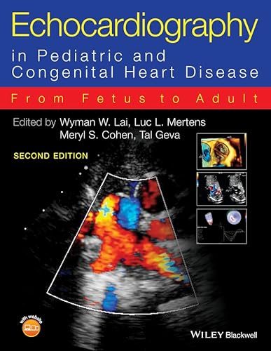 Stock image for Echocardiography in Pediatric and Congenital Heart Disease: From Fetus to Adult for sale by Bulrushed Books