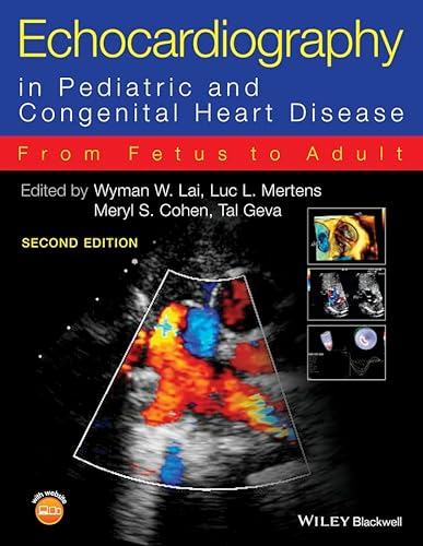 9780470674642: Echocardiography in Pediatric and Congenital Heart Disease: From Fetus to Adult