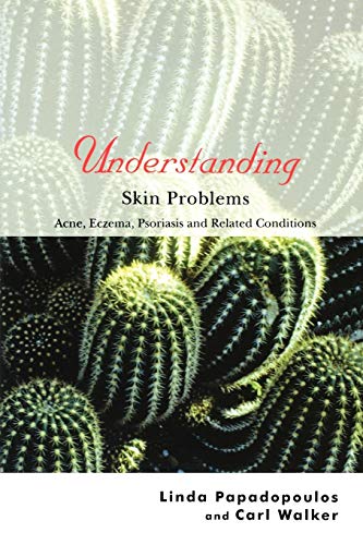 Beispielbild fr Understanding Skin Problems : Acne, Eczema, Psoriasis and Related Conditions zum Verkauf von Better World Books