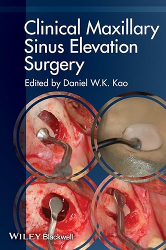 Imagen de archivo de Clinical Maxillary Sinus Elevation Surgery a la venta por Blackwell's