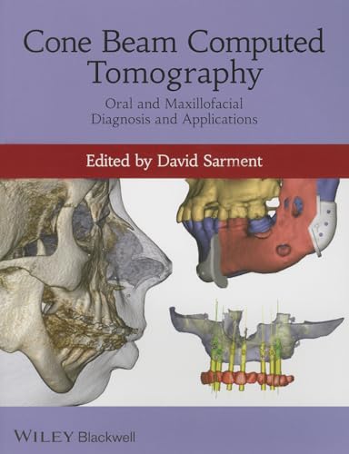 Stock image for Cone Beam Computed Tomography: Oral and Maxillofacial Diagnosis and Applications for sale by Book Deals