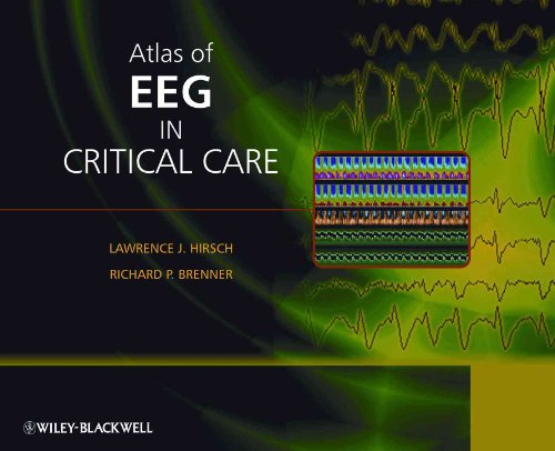 9780470987865: Atlas of EEG in Critical Care