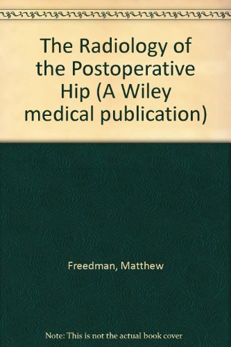 The Radiology of the Postoperative Hip (A Wiley medical publication)