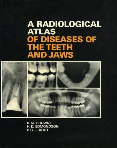 Beispielbild fr Radiological Atlas of Diseases of the Teeth and Jaws zum Verkauf von Zubal-Books, Since 1961