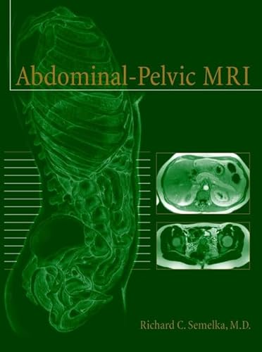 9780471414766: Abdominal-Pelvic MRI