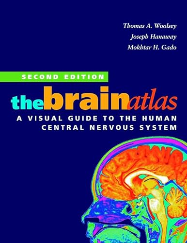 The brain atlas : a visual guide to the human central nervous system by Thomas A. Woolsey, Joseph...