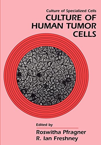 Stock image for Culture of Human Tumor Cells for sale by Wonder Book