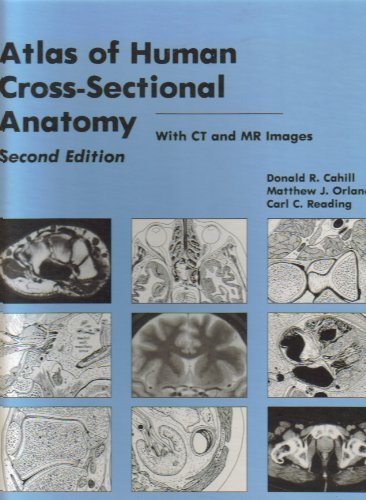 Imagen de archivo de Atlas of Human Cross-Sectional Anatomy a la venta por Better World Books