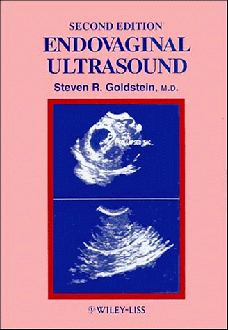 9780471560920: Endovaginal Ultrasound, 2nd Edition