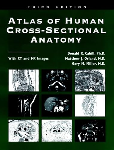 Atlas of Human Cross-Sectional Anatomy: With CT and MR Images (9780471591658) by Cahill, Donald R.; Orland, Matthew J.; Miller, Gary M.