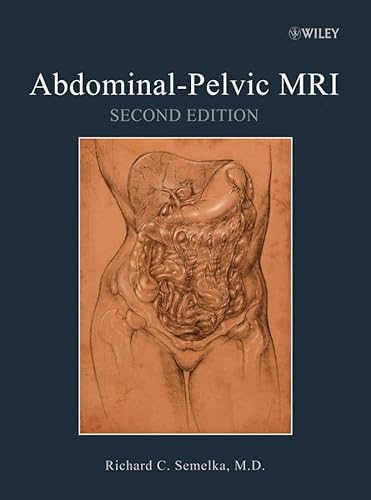 9780471692737: Abdominal-Pelvic MRI