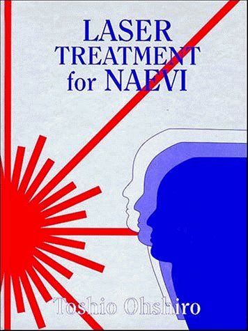 9780471952435: Laser Treatment for Naevi