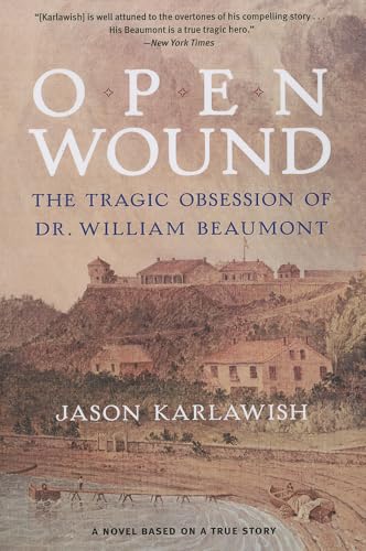 Stock image for Open Wound: The Tragic Obsession of Dr. William Beaumont for sale by Front Cover Books