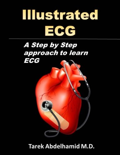 Beispielbild fr Illustrated ECG: A step by step approach to learn ECG zum Verkauf von Revaluation Books