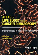 9780473151843: Atlas of Live Blood Through Darkfield Microscopy (With Dvd)