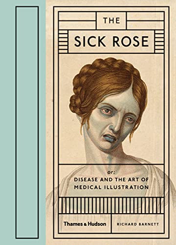 9780500517345: Sick Rose: Disease In The Golden Age Of Medical: Or; Disease and the Art of Medical Illustration