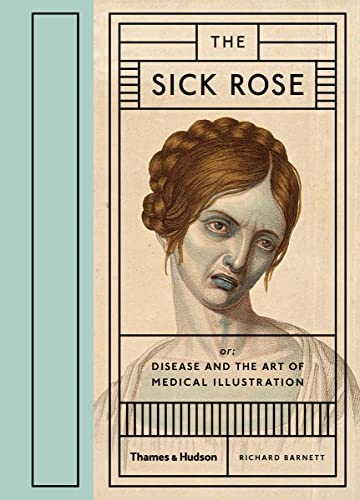 9780500517345: The Sick Rose Disease and the Art of Medical Illustration /anglais