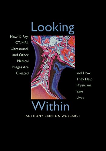 Beispielbild fr Looking Within: How X-Ray, CT, MRI, Ultrasound, and Other Medical Images Are Created, and How They Help Physicians Save Lives zum Verkauf von SecondSale