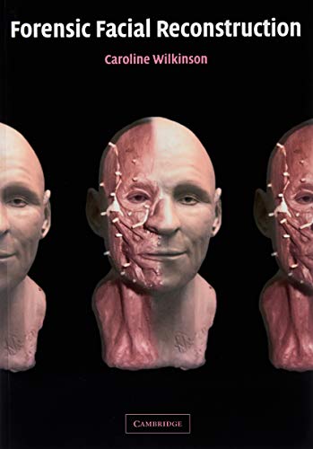 9780521090124: Forensic Facial Reconstruction