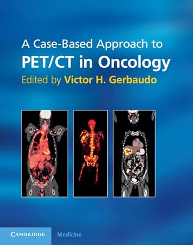 Stock image for A Case-Based Approach to PET/CT in Oncology for sale by Prior Books Ltd