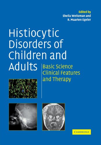 Stock image for Histiocytic Disorders of Children and Adults: Basic Science, Clinical Features and Therapy for sale by HPB-Red