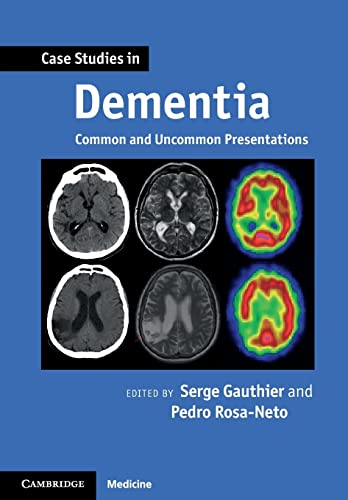 9780521188302: Case Studies in Dementia: Common And Uncommon Presentations