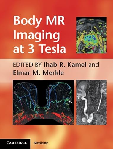 Stock image for Body MR Imaging at 3 Tesla for sale by Better World Books