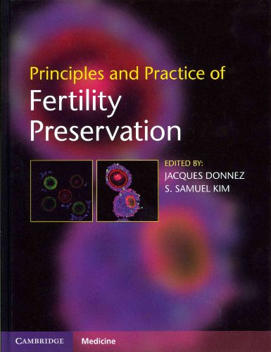 Imagen de archivo de Principles and Practice of Fertility Preservation a la venta por Cambridge Rare Books