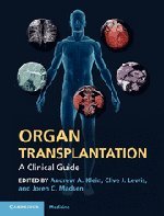 Stock image for Organ Transplantation: A Clinical Guide for sale by WorldofBooks
