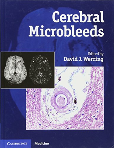 Stock image for Cerebral Microbleeds for sale by Blackwell's