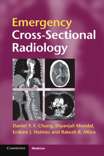 Stock image for Emergency Cross-Sectional Radiology for sale by Better World Books Ltd