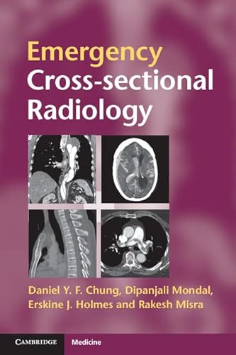 9780521279536: Emergency Cross-sectional Radiology (Cambridge Medicine (Paperback))