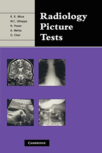 Imagen de archivo de Radiology Picture Tests: Film Viewing and Interpretation for Part 1 FRCR a la venta por GF Books, Inc.