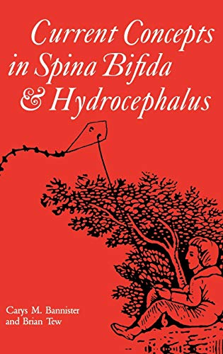 Stock image for Current Concepts in Spina Bifida and Hydrocephalus (Clinics in Developmental Medicine (Mac Keith Press)) for sale by G.J. Askins Bookseller