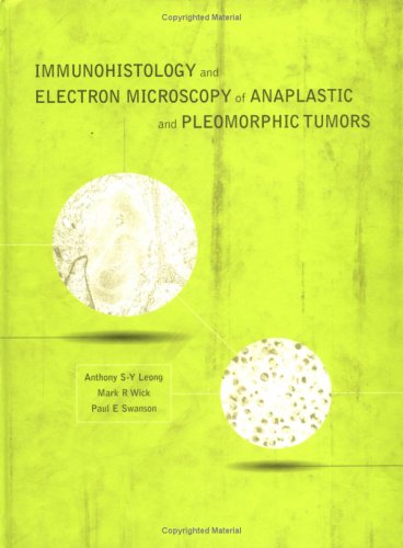 Imagen de archivo de Immunohistology and Electron Microscopy of Anaplastic and Pleomorphic a la venta por Hawking Books