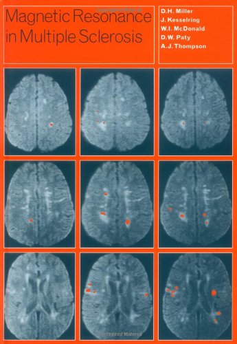 Beispielbild fr Magnetic Resonance in Multiple Sclerosis zum Verkauf von Labyrinth Books