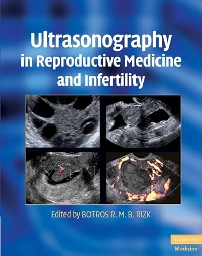 9780521509763: Ultrasonography in Reproductive Medicine and Infertility (Cambridge Medicine (Hardcover))