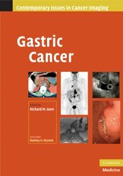 Stock image for Gastric Cancer (Contemporary Issues in Cancer Imaging) for sale by AwesomeBooks