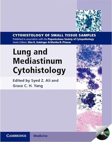 Stock image for Lung and Mediastinum Cytohistology with CD-ROM (Cytohistology of Small Tissue Samples) for sale by Pangea