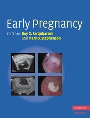 9780521517089: Early Pregnancy
