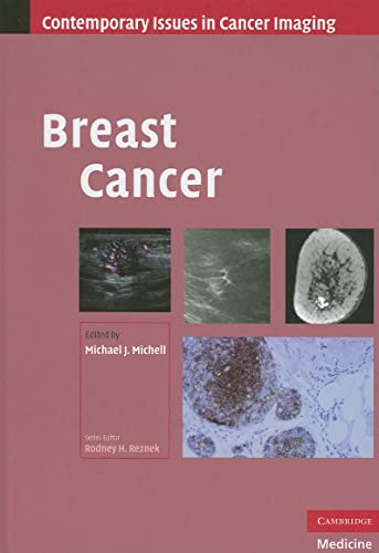 BREAST CANCER (CONTEMPORARY ISSUES IN CANCER IMAGING)