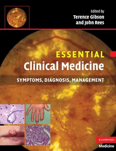 Beispielbild fr Essential Clinical Medicine: Symptoms, Diagnosis, Management (Essential Medical Texts for Students and Trainees) zum Verkauf von AwesomeBooks